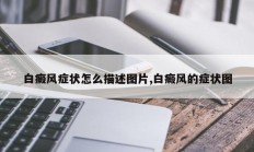 白癜风症状怎么描述图片,白癜风的症状图