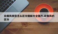 白癜风类型怎么区分图解大全图片,白癜风的区分