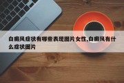白癜风症状有哪些表现图片女性,白癜风有什么症状图片