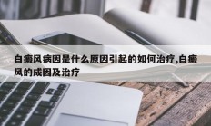 白癜风病因是什么原因引起的如何治疗,白癜风的成因及治疗