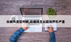 白癜风类型判断,白癜风怎么区分严不严重