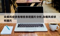 白癜风症状有哪些表现图片分析,白癜风症状和图片