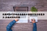 白癜风治疗药物目录最新手册图片及价格是多少,白癜风特效药物